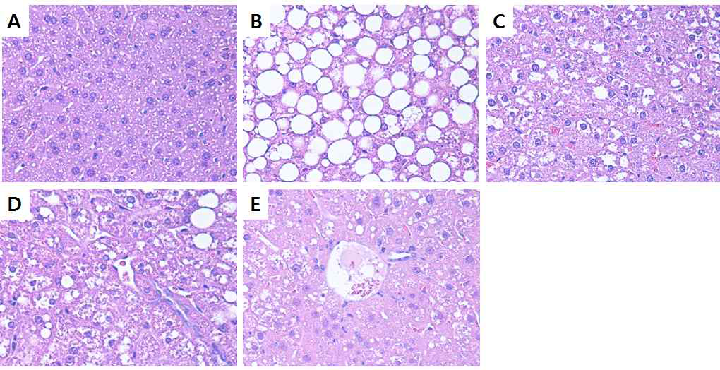 Effect of xylobiose on histopathology in mouse liver tissue.