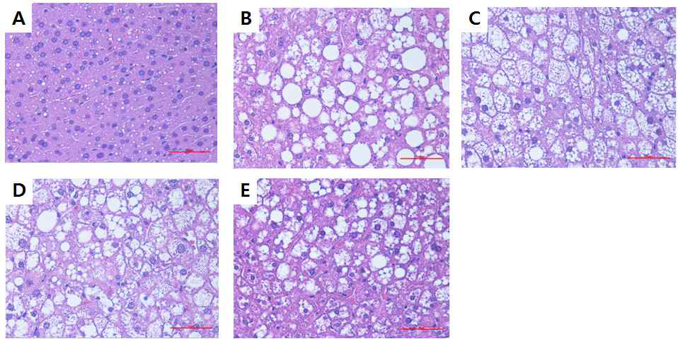 Effect of phyllodulcin on histopathology in mouse liver tissue.