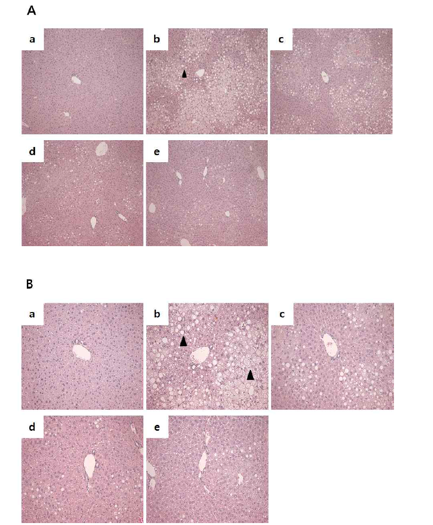 Effect of xylobiose, xylose on histopathological features of mouse in high fat-induced obese mice