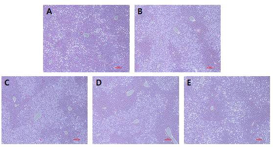 Effect of phyllodulcin on histopathology in mouse liver tissue