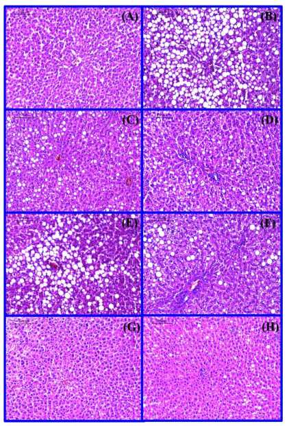 Histological analysis of the liver from hyperlipidemic rats fed a HCD and treated with simvastatin, oxyresveratrol, ethanol extract of Morus alba stem, or omega-3.