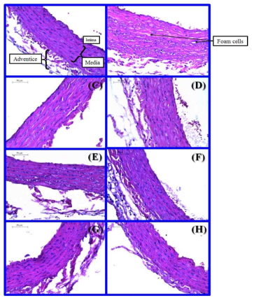 Histological analysis of aorta tissues from hyperlipidemic rats fed a HCD and treated with simvastatin, oxyresveratrol, ethanol extract of Morus alba stem, or omega-3.