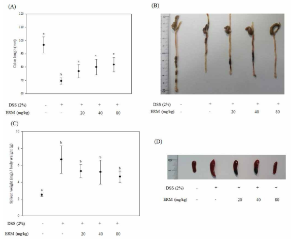 상지추출물의 대장염모델의 장 길이와 비장무게 변화효과 장 길이 변화 (A, B)와 비장무게 변화 (C, D)