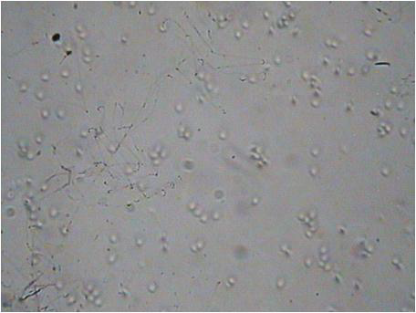 과열수증기 처리 후 시료에 잔존하는 미생물의 현미경 사진(X1,000).