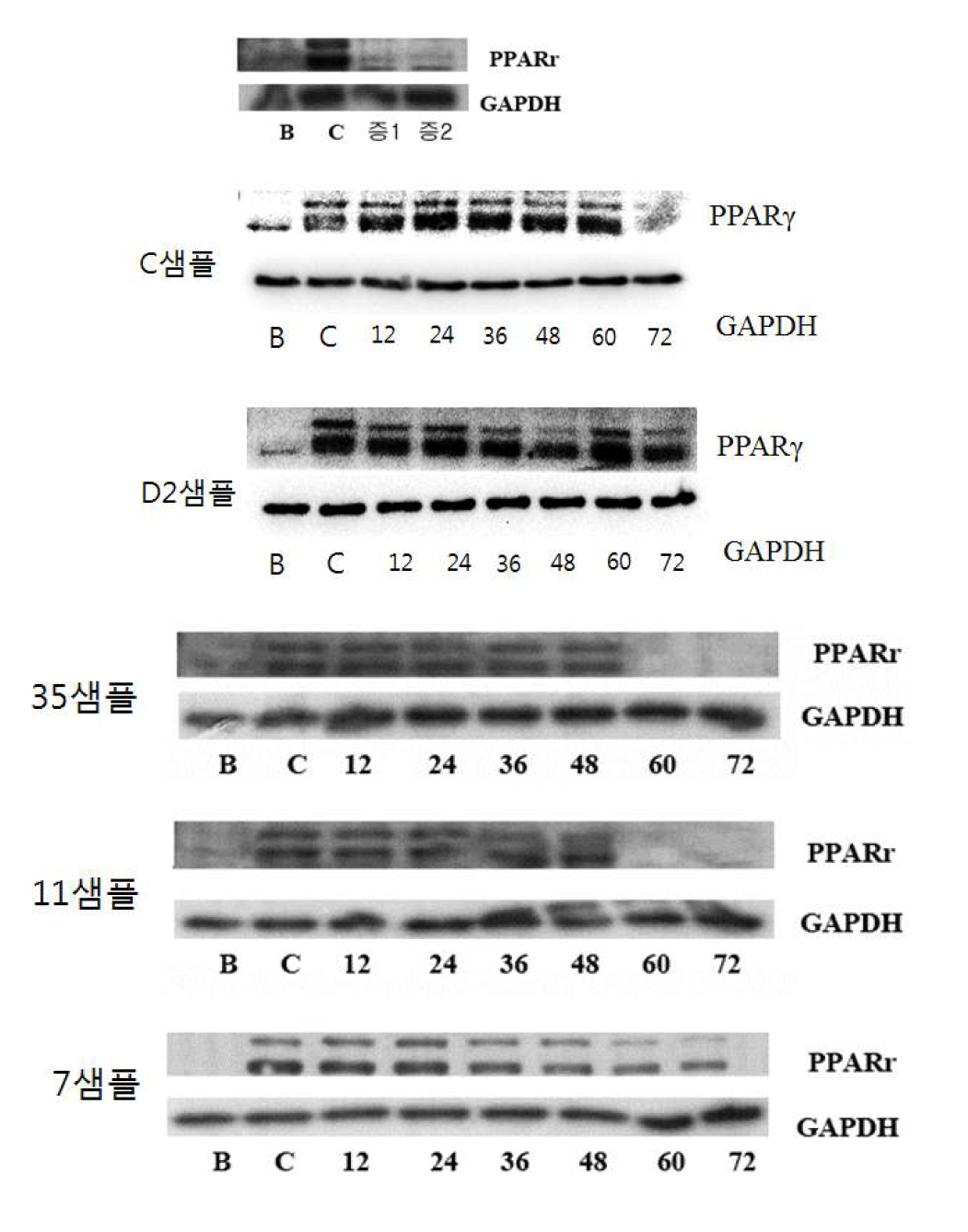 PPARγ발현량 억제 (Western blot)