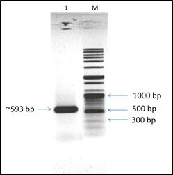 PCR amplification of metal dependent hydrolase gene by using BCP22 genome as template. 1: metal dependent hydrolase gene, M: Marker