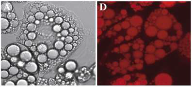 지방세포의 Lipid droplet(중성지질)에 염색된 Nile red