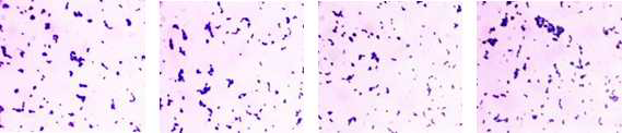 항비만 미생물 선도소재 3, 10, 11, 15의 gram staining morphology