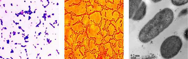 JBD301 Lactobacillus의 Gram staining, Nile Red staining, TEM images