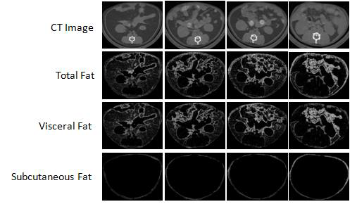 The representive in vivo micro-CT image at 12 week.