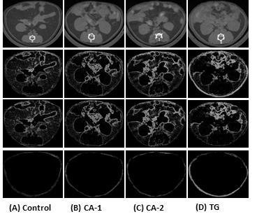 The representive in vivo micro-CT image used for comparative analysis of the mice treated with the Tangerine and CA at 12 week.