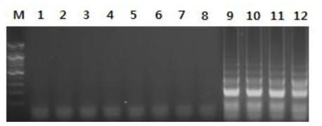 Specificity of reverse transcription loop-mediated isothermal amplification for amplification of the matrix gene of swine influenza virus (SIV).