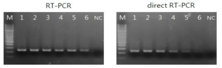 Comparison of the sensitivity between commercial RT-PCR (RT-PCR) and direct RT-PCR (dRT-PCR) in detecting influenza virus