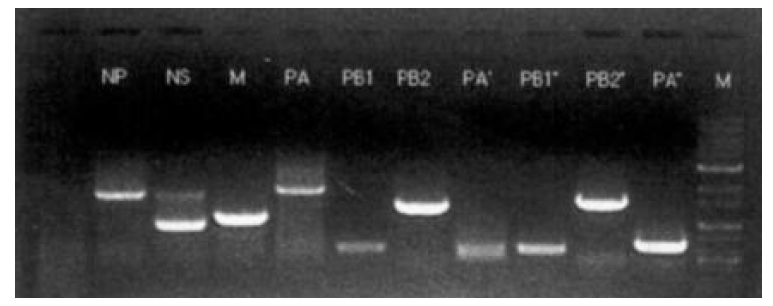 RT-PCR수행 후 electrophoresis를 통한 PCR 산물 확인