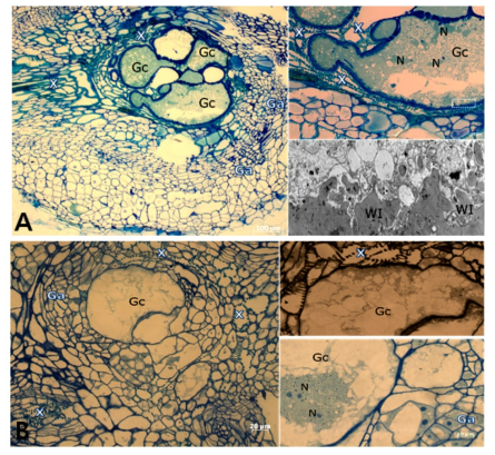 뿌리혹선충 감염부위의 현미경사진