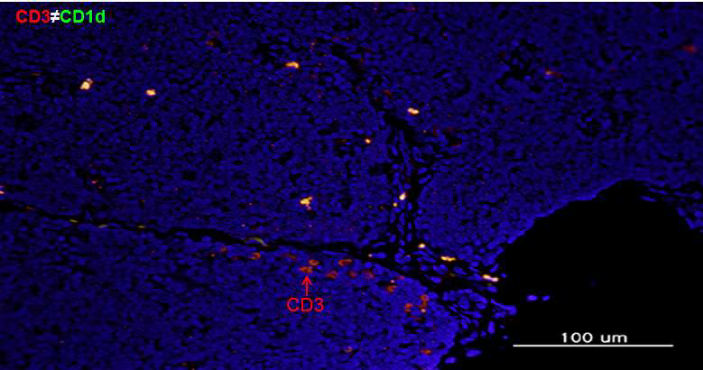 Colocalization of CD3 and CD1d in IL2RG KO pigs