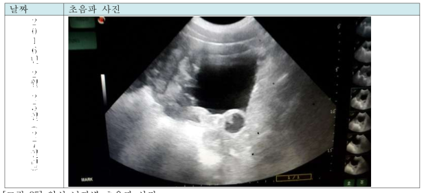임신 날짜별 초음파 사진
