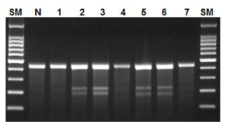 Mono-allelic modification of IL-2RG.