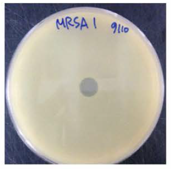 MRSA에 대한 박테리오파지의 효능 평가 사진