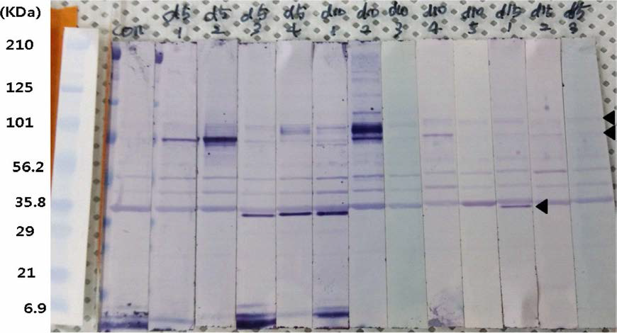 박테리오파지의 경구 투여에 의한 항체 생성 여부 검사를 위한 western blotting 결과
