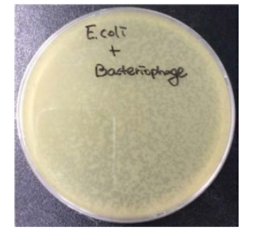 부종병 대장균 특이 박테리오파지 효능 검증