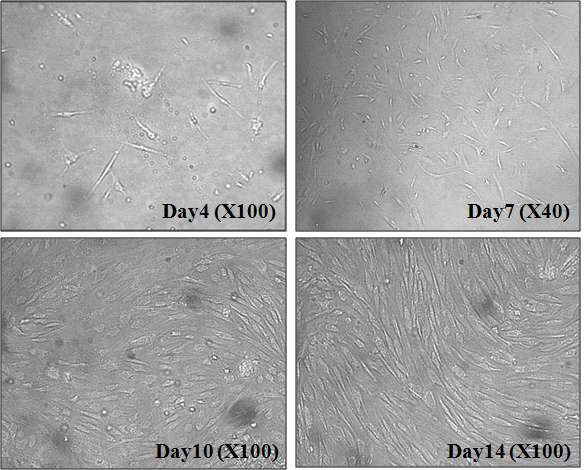 파킨슨 환자 및 대조군으로부터 얻은 지방유래 간엽줄기세포의 cell morphology