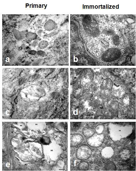 파킨슨환자 및 뇌하수체 선종 환자의 지방유래 간엽줄기세포의 Primary와 Immortalized 세포의 미토 콘드리아 형태의 Electron micrograph