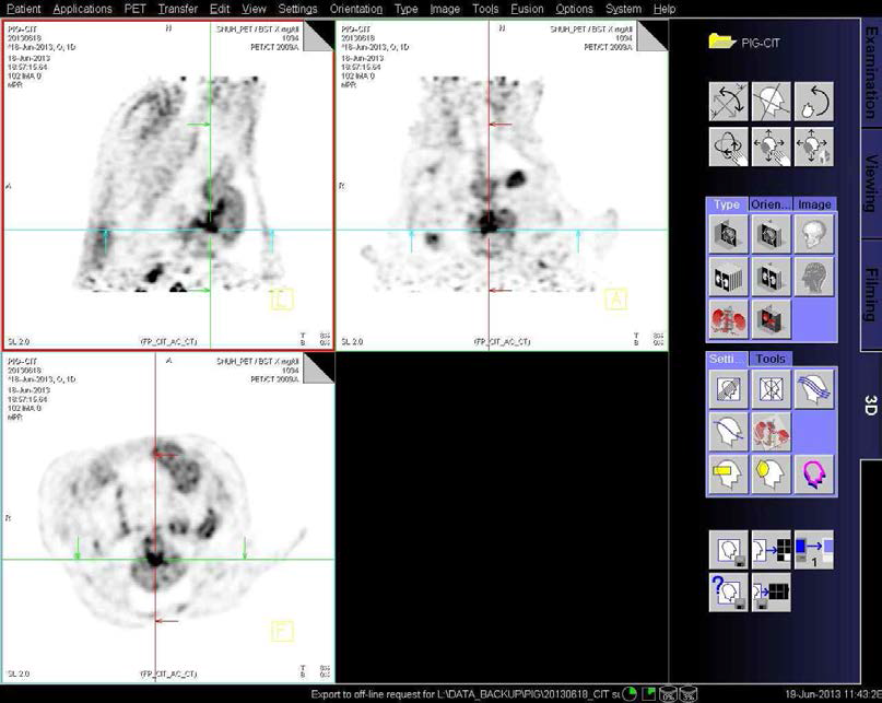 신경독성물질 투여 PD 모델 미니돼지의 F-CIT 주입후의 뇌 PET 이미지