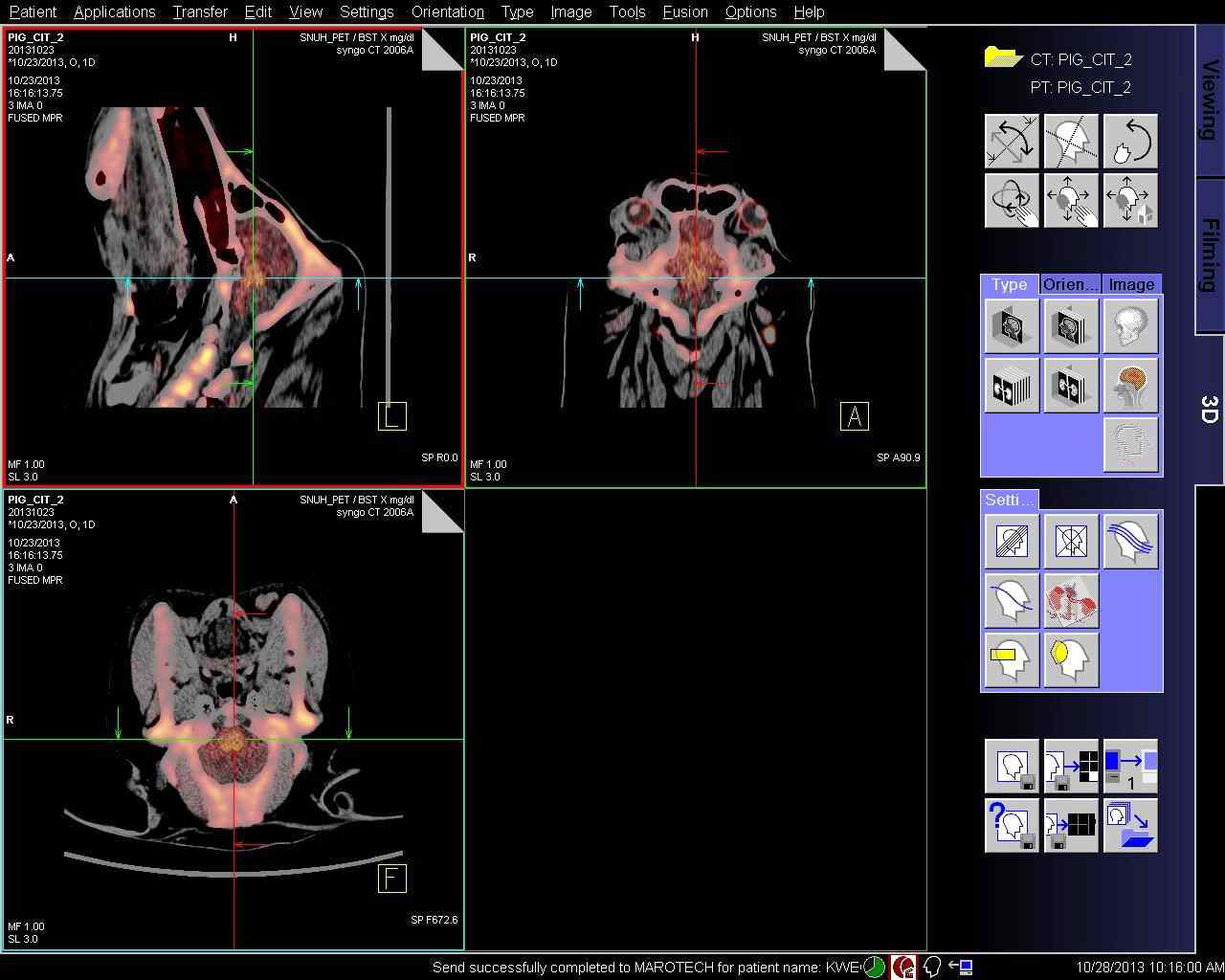정상 미니돼지의 F-CIT 주입 후의 뇌 PET-CT fusion 이미지.