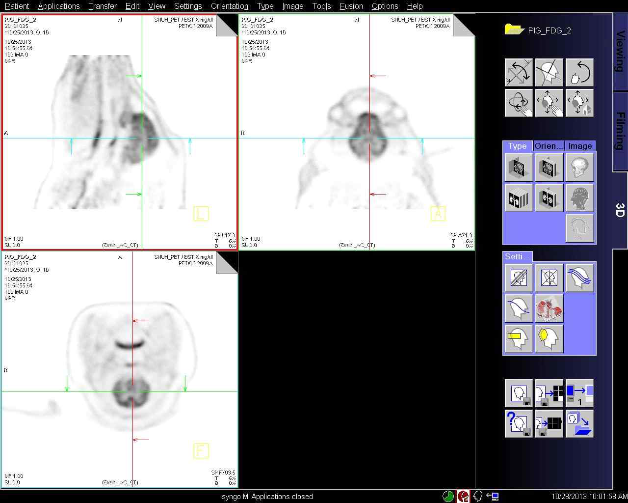 정상 미니돼지의 FDG 주입 후의 뇌 PET 이미지.