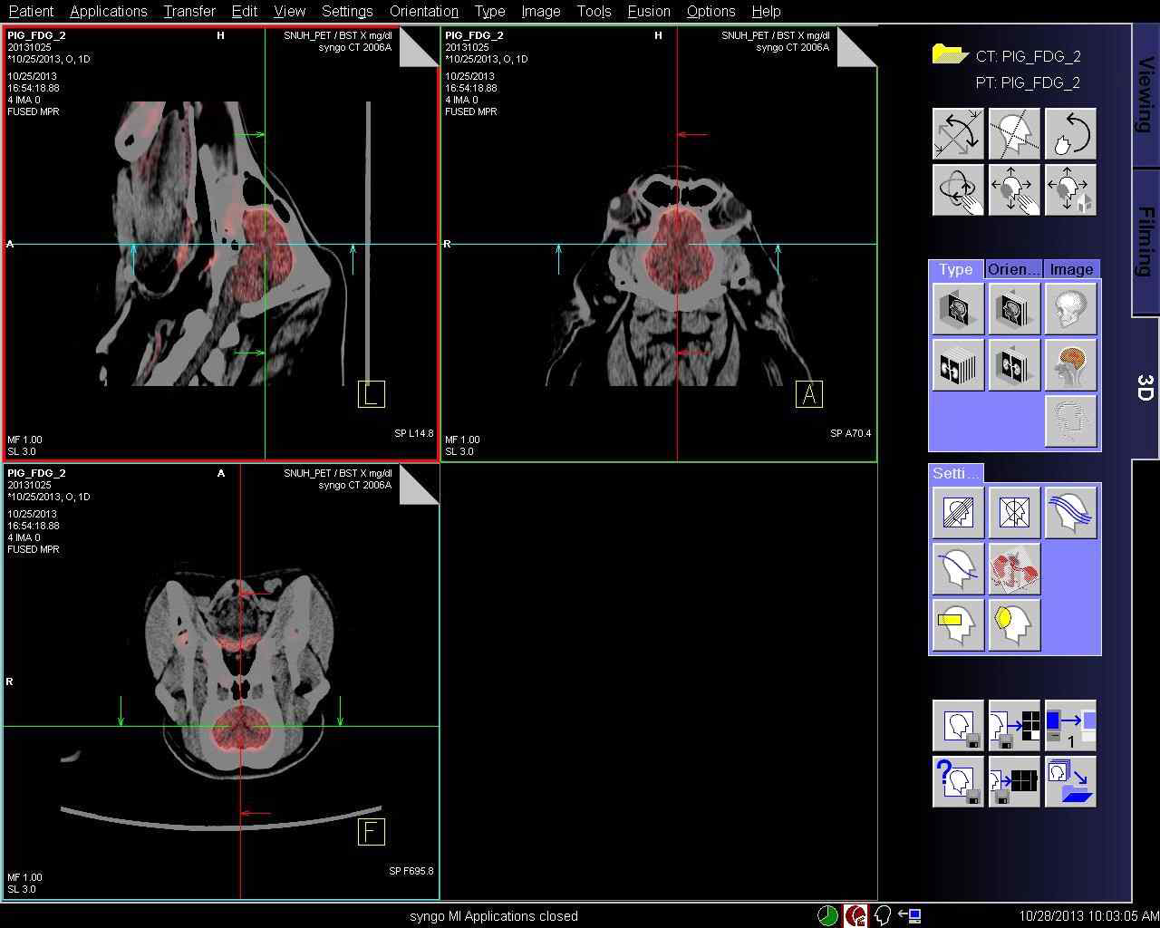 정상 미니돼지의 FDG 주입 후의 뇌 PET-CT fusion 이미지.