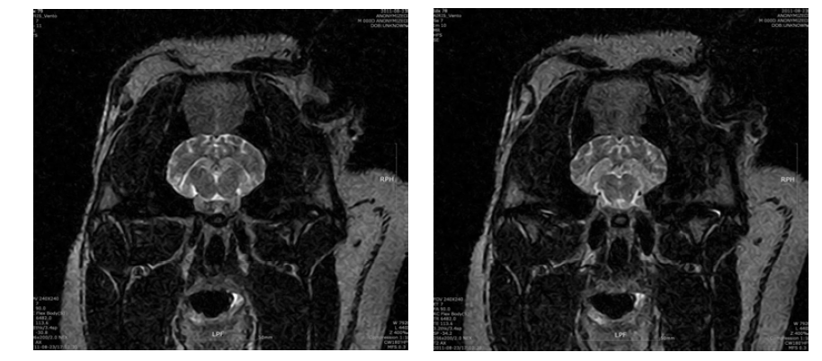 신경독성물질 투여 PD 모델 미니돼지의 뇌 MRI coronal 이미지.