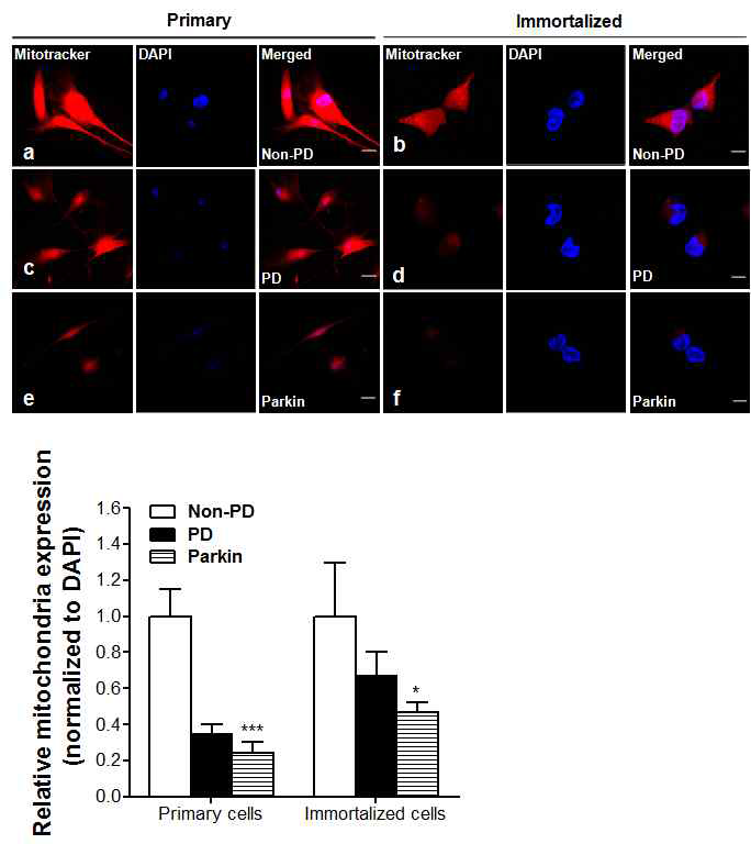 파킨슨환자 및 뇌하수체 선종환자의 지방유래 간엽줄기세포의 일차배양과 불멸화된 세포의 미토콘 드리아 손상을 재확인한 mitotracker staining.