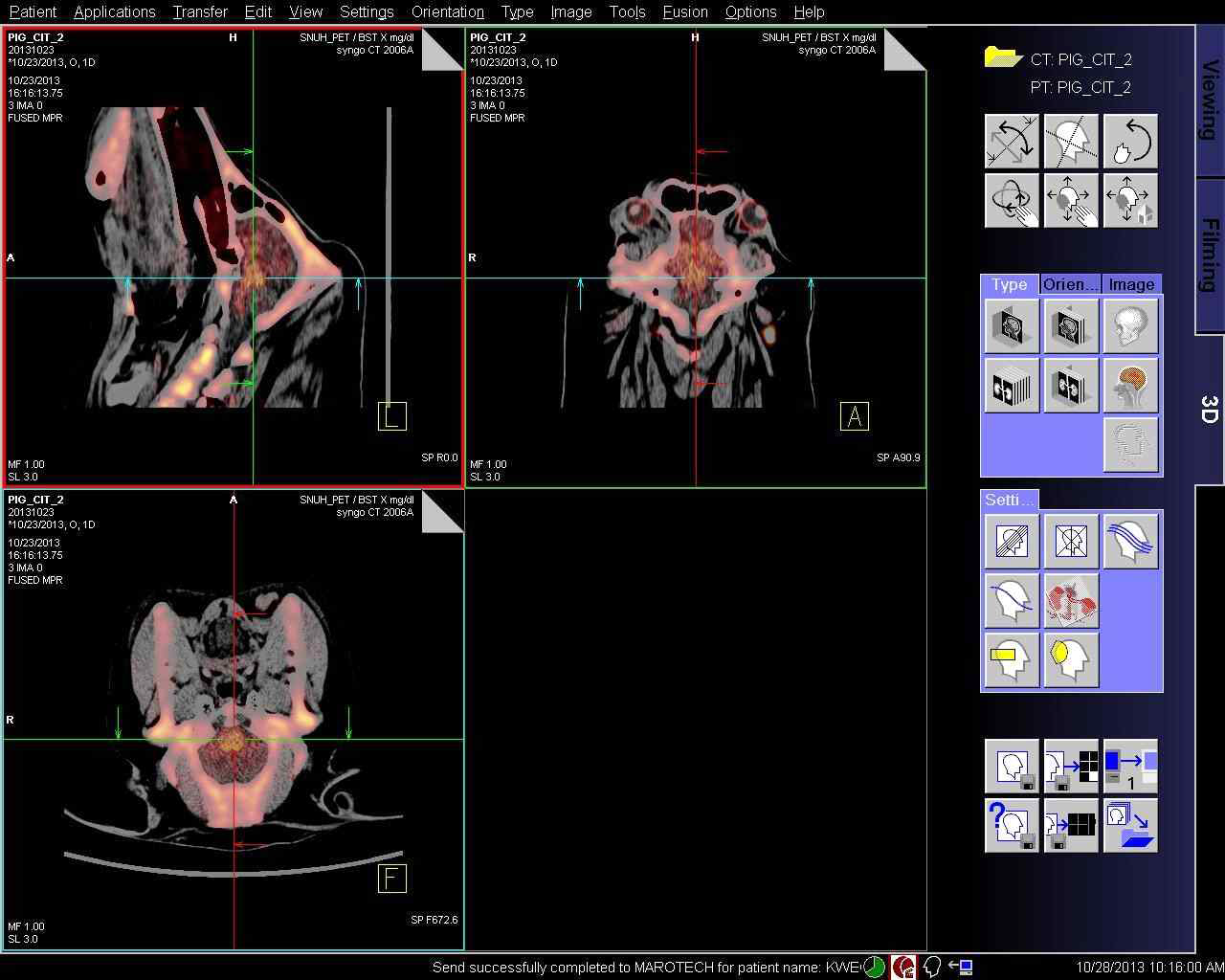 1년령 정상 미니돼지의 F-CIT 주입 후의 뇌 PET-CT fusion 이미지.