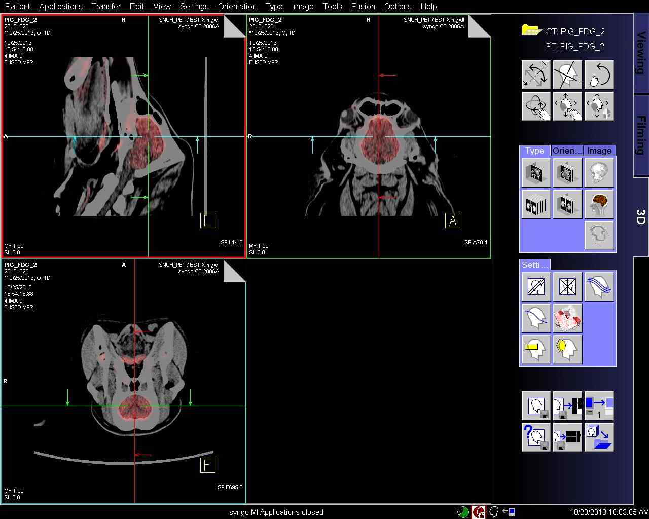 1년령 정상 미니돼지의 FDG 주입 후의 뇌 PET-CT fusion 이미지.