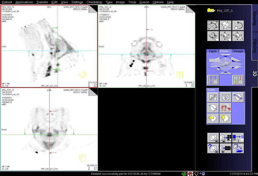 1년령 hAPP 유전자 조절 미니돼지의 F-CIT 주입후의 뇌 PET 이미지.