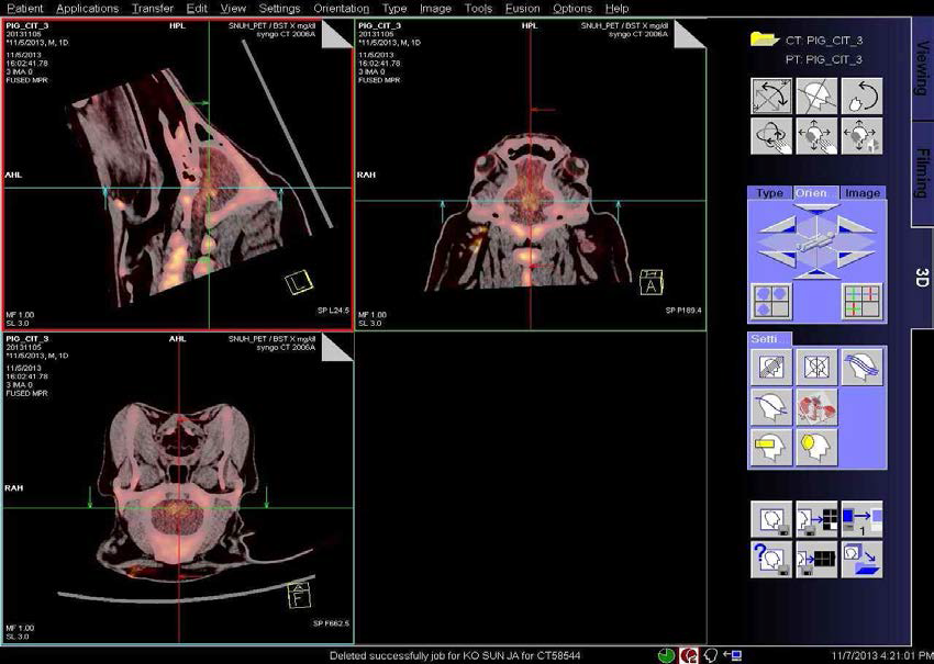 1년령 hAPP 유전자 조절 미니돼지의 F-CIT 주입후의 뇌 PET-CT fusion 이미지