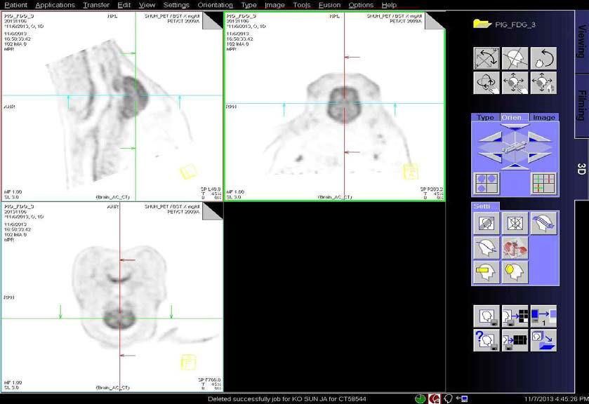 1년령 hAPP 유전자 조절 미니돼지의 FDG 주입후의 뇌 PET 이미지.