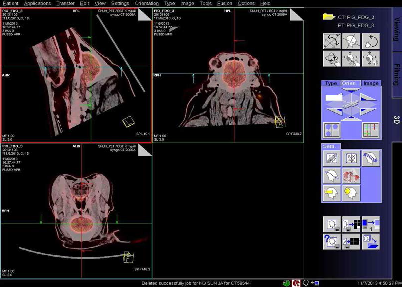 1년령 hAPP 유전자 조절 미니돼지의 FDG 주입후의 뇌 PET-CT fusion 이미지.