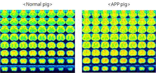 1년령 hAPP 유전자 조절 미니돼지와 정상미니돼지의 FDG 주입후의 뇌 PET-CT fusion 이미지의 비교.