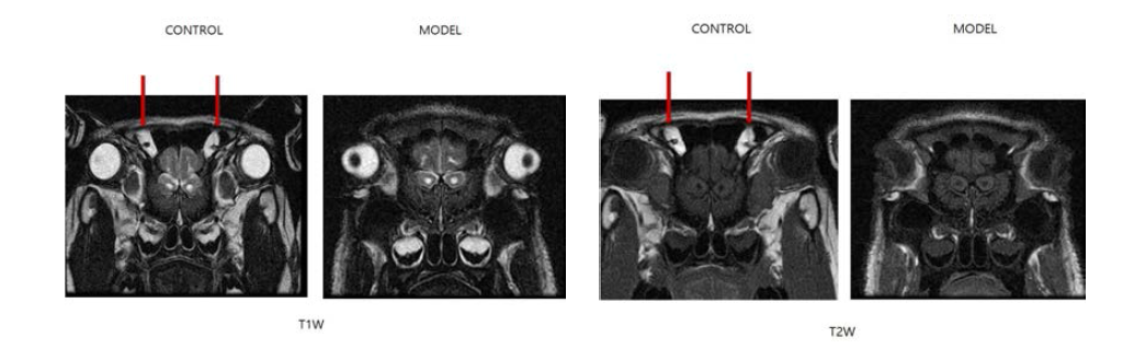 1년령 hAPP 유전자 조절 미니돼지의 뇌 MRI 이미지.