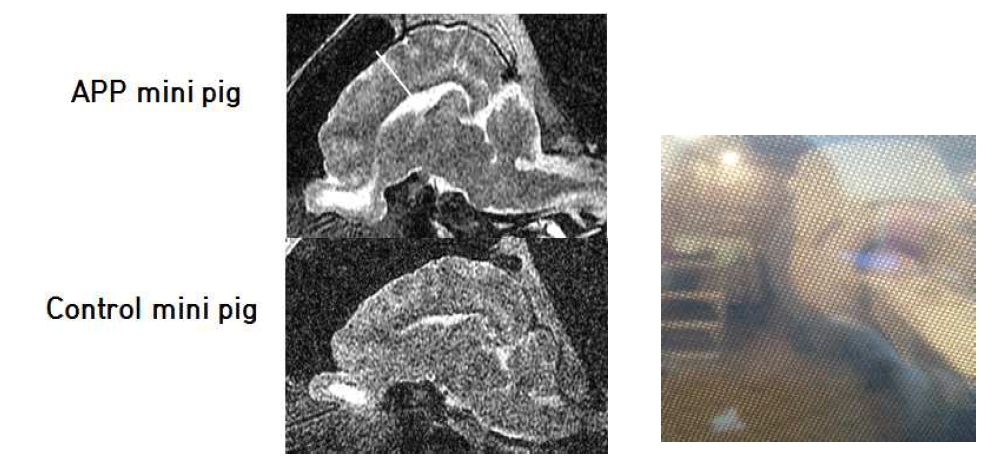 2년령 hAPP 유전자 발현 미니돼지의 MRI에 관한 영상 결과