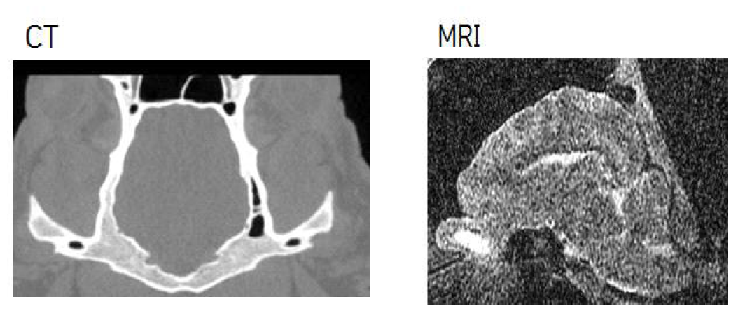 1년령 hSNCA 발현 미니돼지의 MRI와 CT에 관한 영상 결과