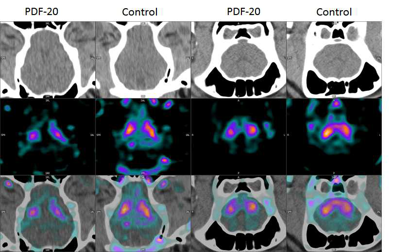 2년령 hSNCA 발현 미니돼지의 FP-CIT의 PET과 CT에 관한 영상 결과