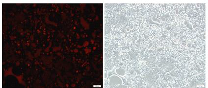 pLVX-hPDGFβ Prom/hSNCA(d121) -CMV/RFP-puro에 의한 RFP 발현. RFP 형광 (좌).