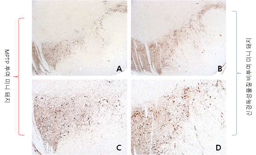 MPTP 투여 미니돼지 및 정상 미니돼지의 면역조직화학염색(부위 2)