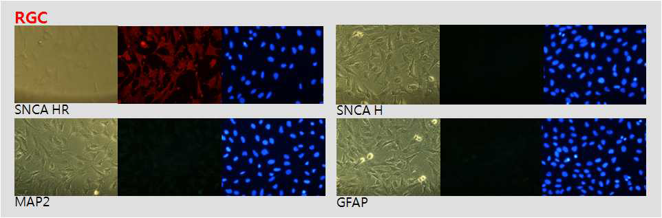 RGC 세포에서 SNCA/HR, SNCA/H, MAP2, GFAP 항체를 이용하여 면역염색 (이상 x200).