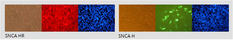 RGC 세포에 PDGF-β promoter-hSNCA 벡터를 도입한 후SNCA/HR(빨강색) 및 SNCA/H (녹색)에 대한 항체를 이용한 면역염색 결과 (이상 x100).