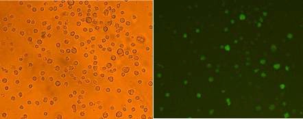 자외선 아래에서 초 록형광단백질(GFP)을 발현하 는 hAPP가 발현되는 공여세 포들
