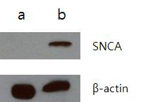 Truncated hSNCA 과발현 세포에서 추출한 단백질을 이용하여 western blot을 진행한 결과